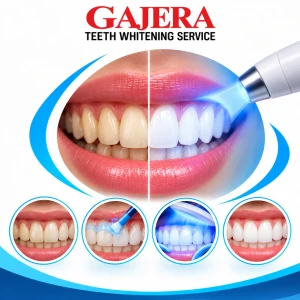 Teeth whitening service